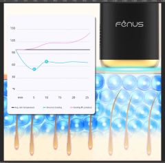 FENUS Depiladora Láser Permanente-De Luz Pulsada IPL Sin Dolor