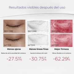Fenus Contorno de Ojos 20 ml con 2% péptido Microcorriente y LED Roja
