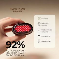 Fenus V1 Set y Gel Conductor Fenus de 300g