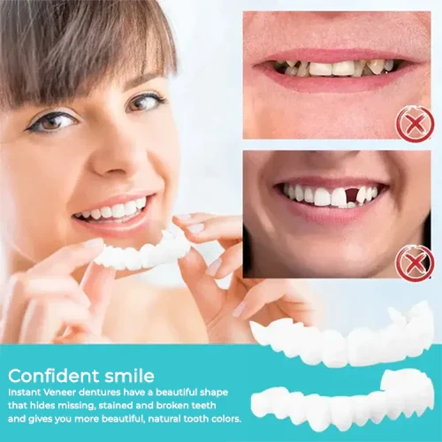 🔥🎁2024 Hot Sale🎁48% OFF - Adjustable Snap-On Dentures-Free Shipping🔥