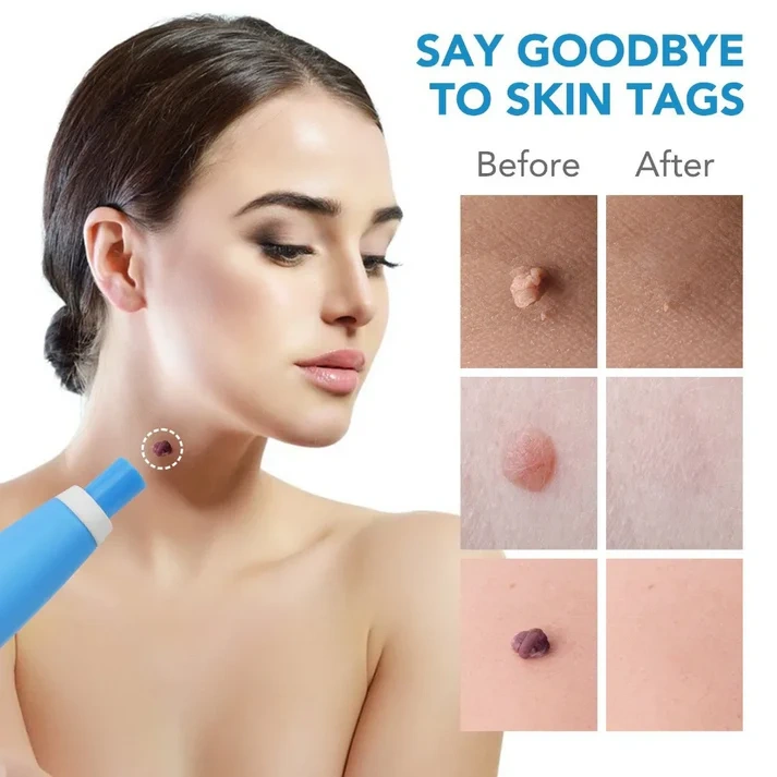 PAINLESS AUTO TAG REMOVER KIT