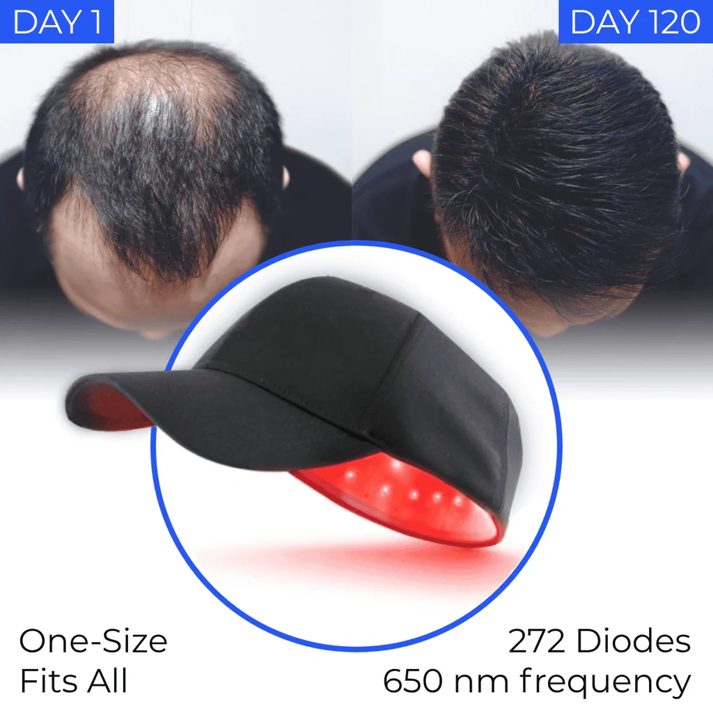 Regrow your hair in 120 days with Nordic® Laser Cap