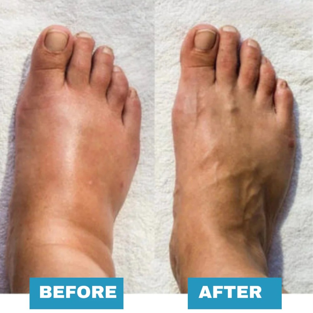 🎉Last Day Sale OFF 50%🔥 Foot Massager For Lasting Foot Pain Relief