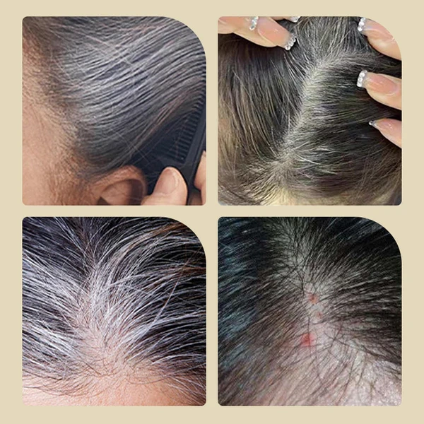Thanksgiving Special🔥🔥Safe and Convenient Comb Hair Dye