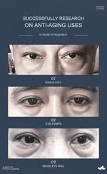Shuai Nan Anti-wrinkle smoothing, firming eye bags and dark circles patch