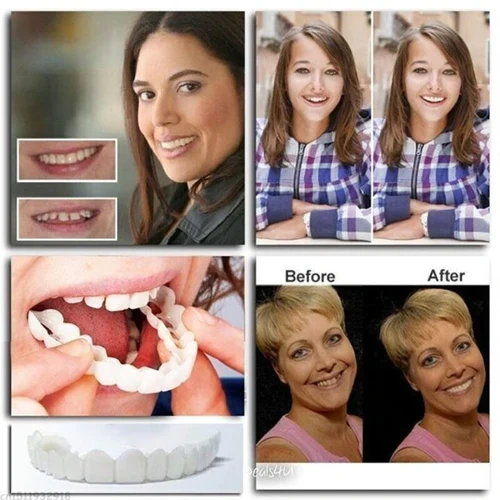 🔥🎁2024 Hot Sale🎁48% OFF - Adjustable Snap-On Dentures-Free Shipping🔥