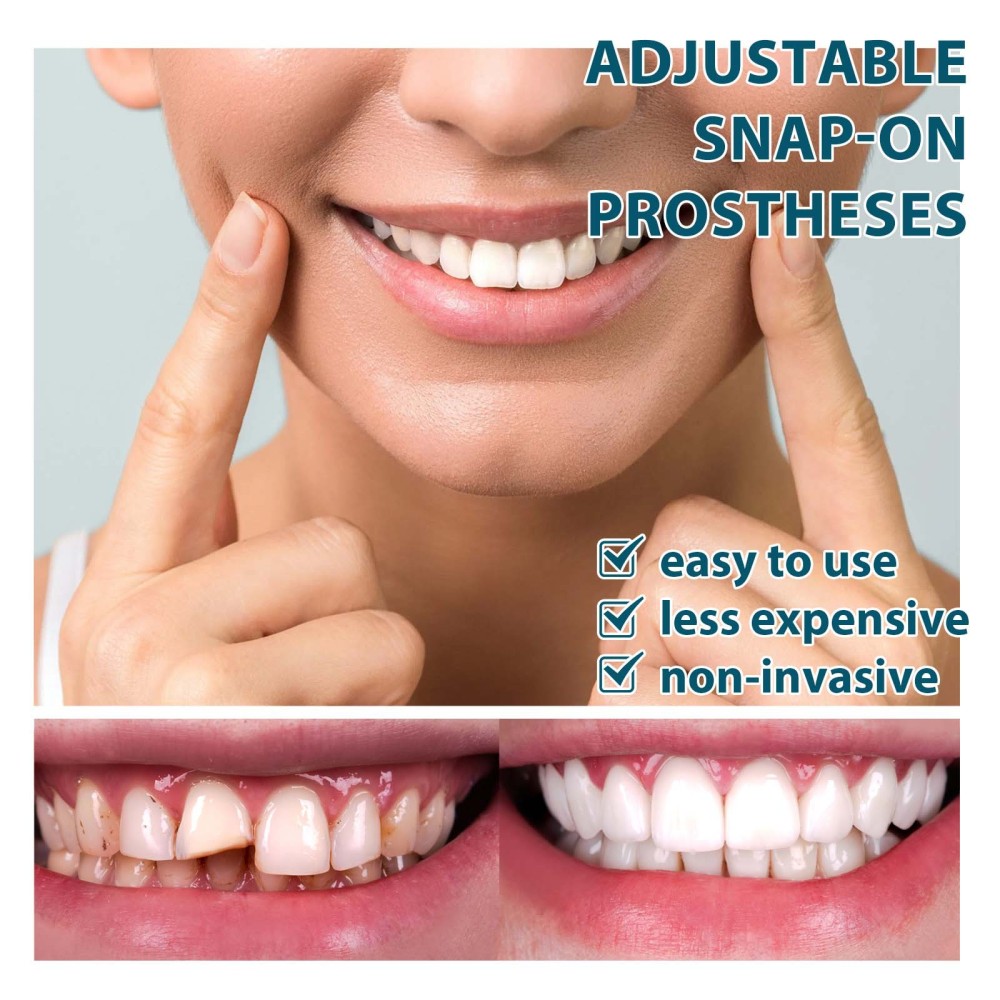 💝EEHLOE💝Latest👨‍⚕Adjustable Snap-On Dentures😁(FREE SHIPPING)