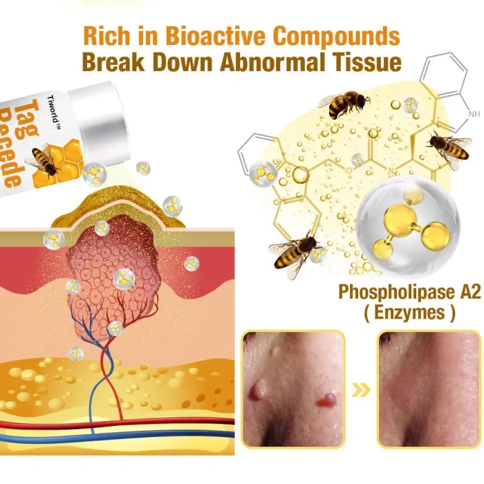 💫PAY FOR 1 TIWORLD™ GET 2 RECEDE TAG 🐝 ⭐⭐⭐⭐⭐ WART AND MOLE SPRAY TREATMENT🐝👨‍⚕