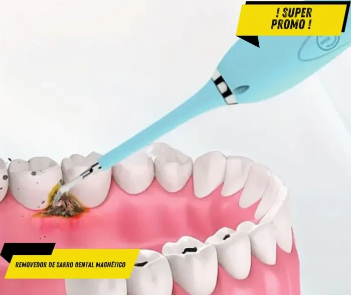 Magnetic Dental Tartar Remover