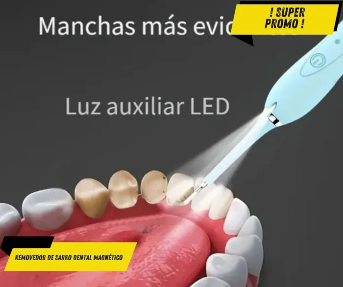 Magnetic Dental Tartar Remover