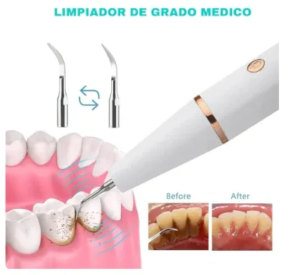 Magnetic Dental Tartar Remover