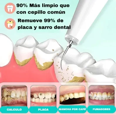 Magnetic Dental Tartar Remover