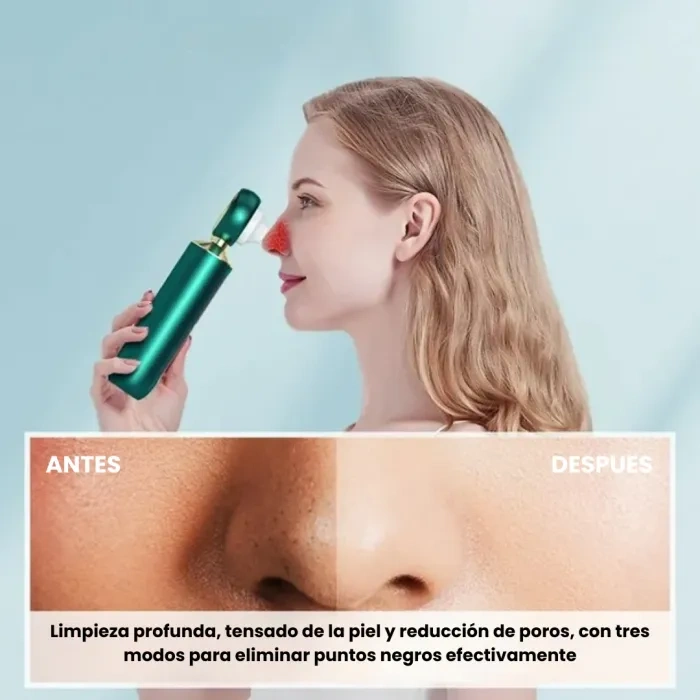BLACKHEAD EXTRACTOR WITH MAGNIFIER