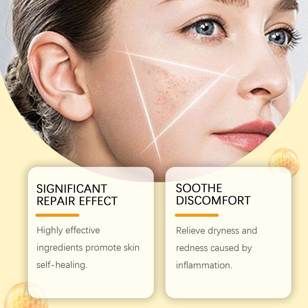 Bee Venom Skin Restoration Cream - Deep Repair, Soothe, Renew, Post-Treatment Care, Cooling Sensation Historical lowest price😁😁😁😁😁