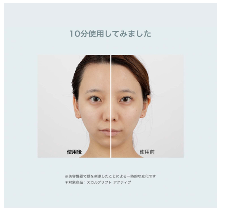 YA-MAN 頭皮電梯 MS82G 頭部肌肉提升刷 面部护理 2022最新