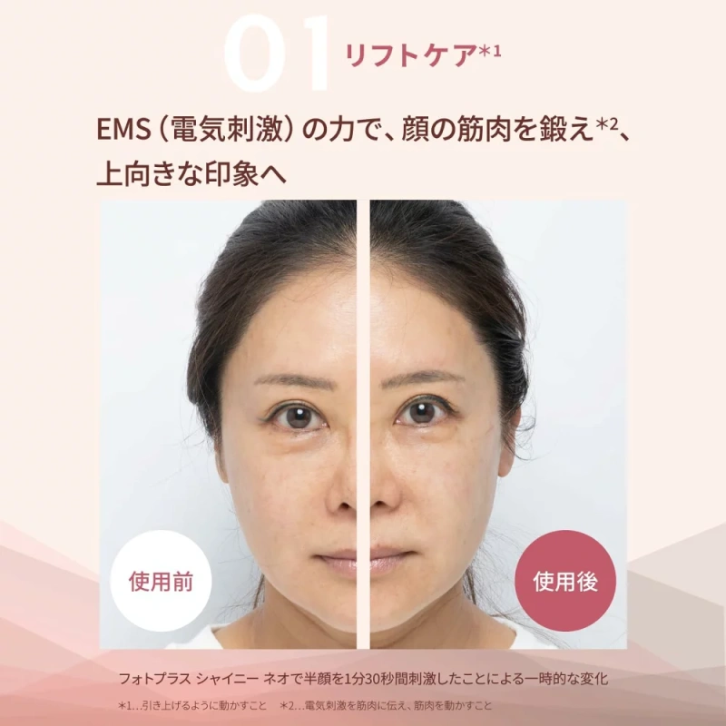 YAMAN 美容儀Photo Plus 閃亮Neo Reft YJFM18N 金色