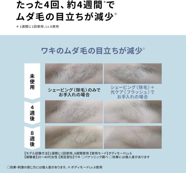 Panasonic 國際牌 ES-NWHJC-H Smooth Epi 光美容儀 冷卻IPL除毛儀 鬍鬚 VIO適用 冷卻功能 男士女士除毛 全身光美容