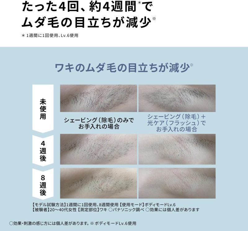 Panasonic 國際牌 ES-NWHJC-H Smooth Epi 光美容儀 冷卻IPL除毛儀 鬍鬚 VIO適用 冷卻功能 男士女士除毛 全身光美容