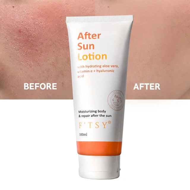 Custom Moisturizing After Sun Repair Private Label Cream 100% Aloe Vera After Sun Lotion For Quality Sunburn Remover