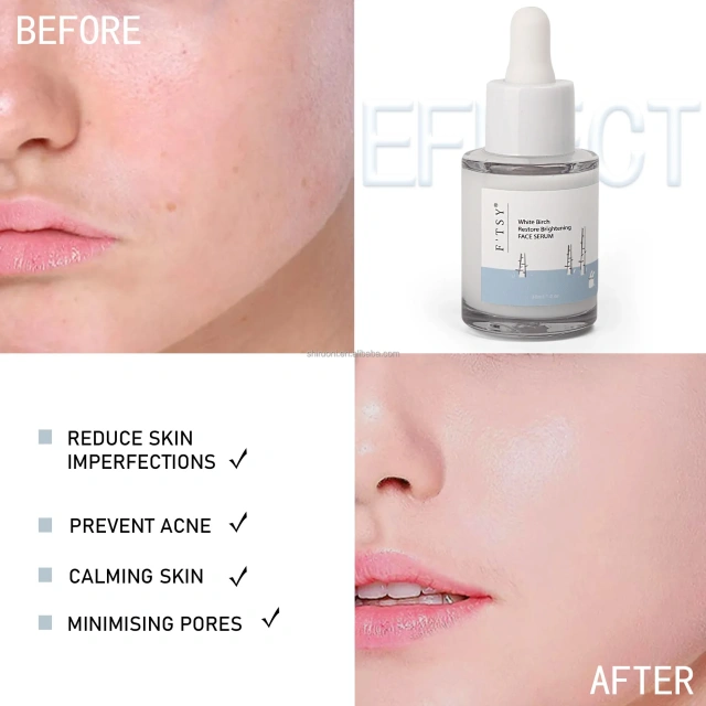 OEM Brand Korea Skin Care Improving Overall Skin Health Rejuvenating Nourishing Birch Juice Face Serum