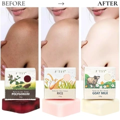 Rice Milk Whitening Soap – Dark Spot Removal & Face Cleansing