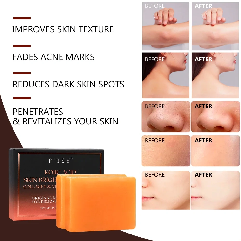 Kojic Acid Turmeric Soap