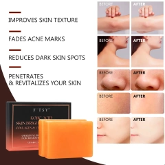 Kojic Acid Turmeric Soap