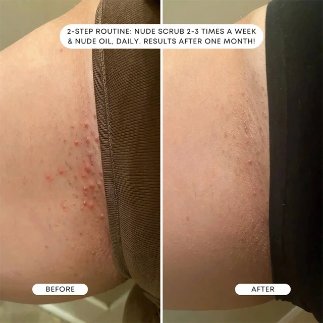 Private Label Moisturize and Soften Skin While Preventing Yoni Vaginal Ingrown Hair Oil Treatment