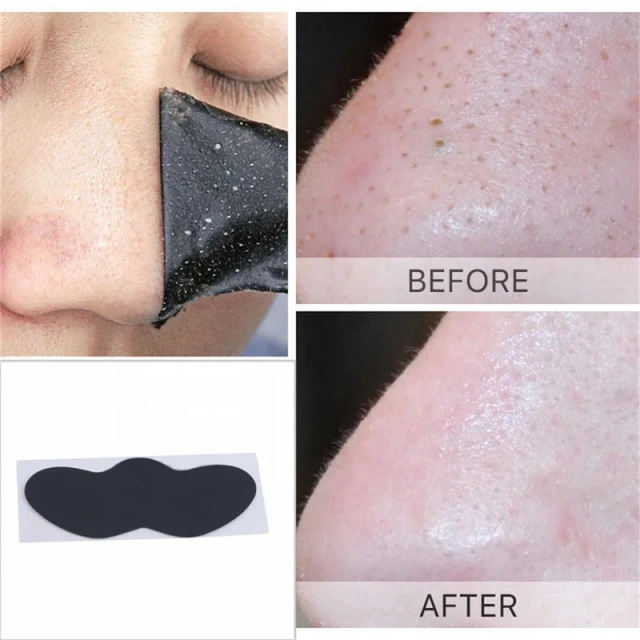 Charcoal Blackhead Removal Nose Strips