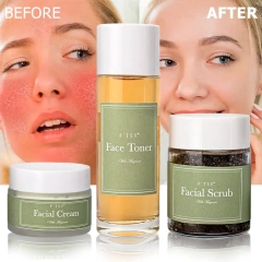 Herbal Mugwort Anti Aging Brightening Kit Mugwort Face Toner Cream Scrub Series Skin Care Set