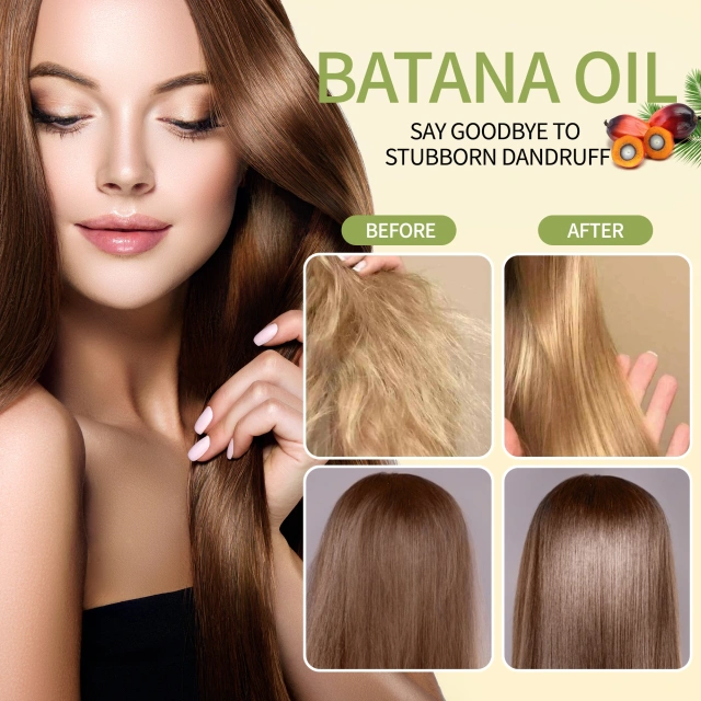 Private Label Eliminates Split Ends Hair Growth Enhances Radiance Batana Hair Oil Bulk