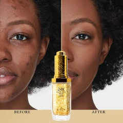 24K Gold Serum, Anti Wrinkle