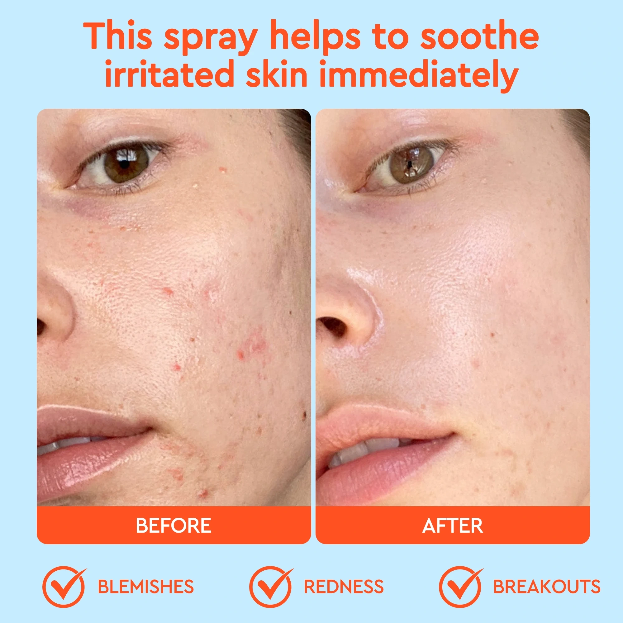 SOS Soothing Purifying Hypochlorous Facial Spray