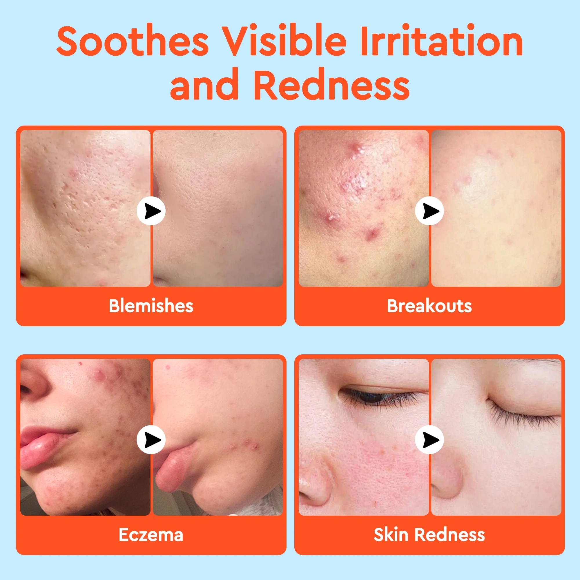 SOS Soothing Purifying Hypochlorous Facial Spray