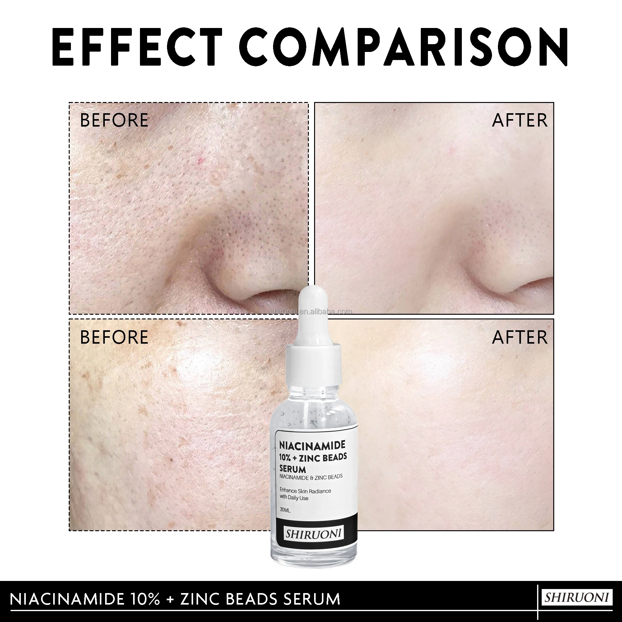 Niacinamide Zinc Beads Serum, Acne & Glow