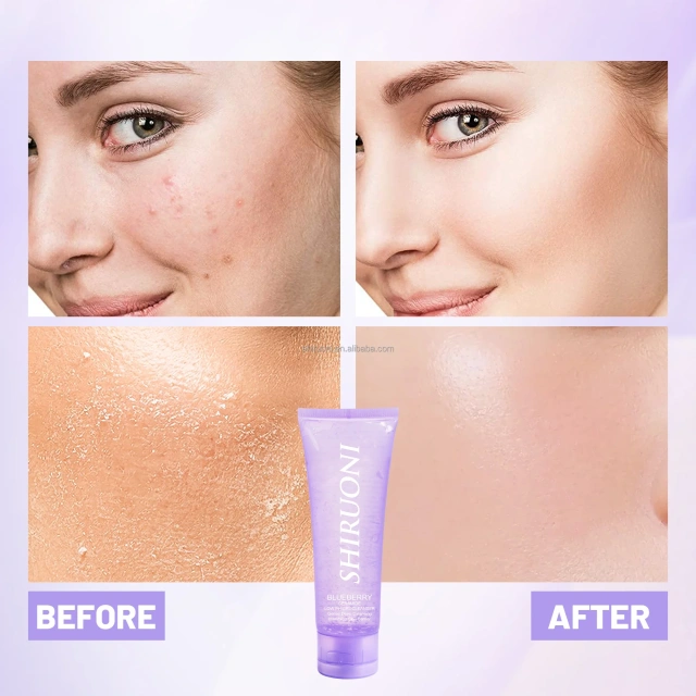 Blueberry Ceramide Gentle Cleanser Gel, Low pH