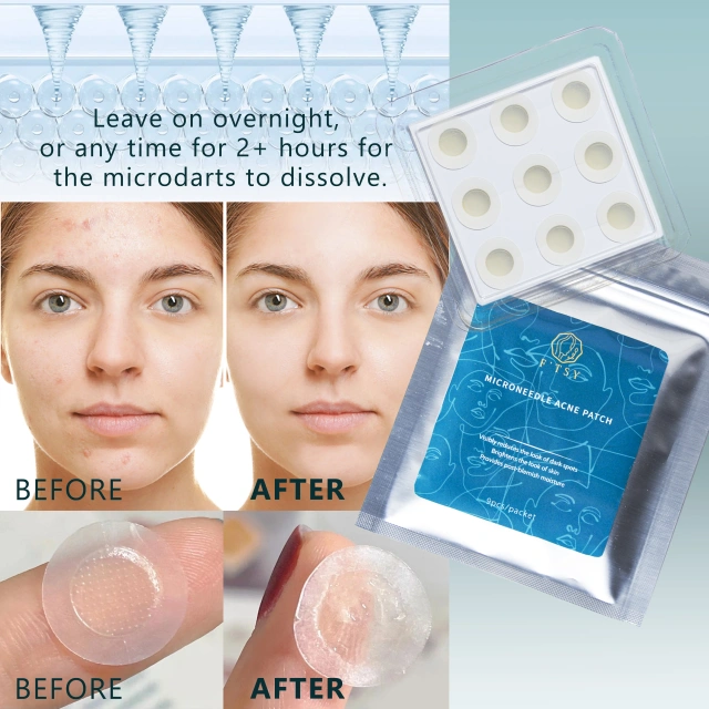 Microneedle Acne Patch – Scar & Blemish Care