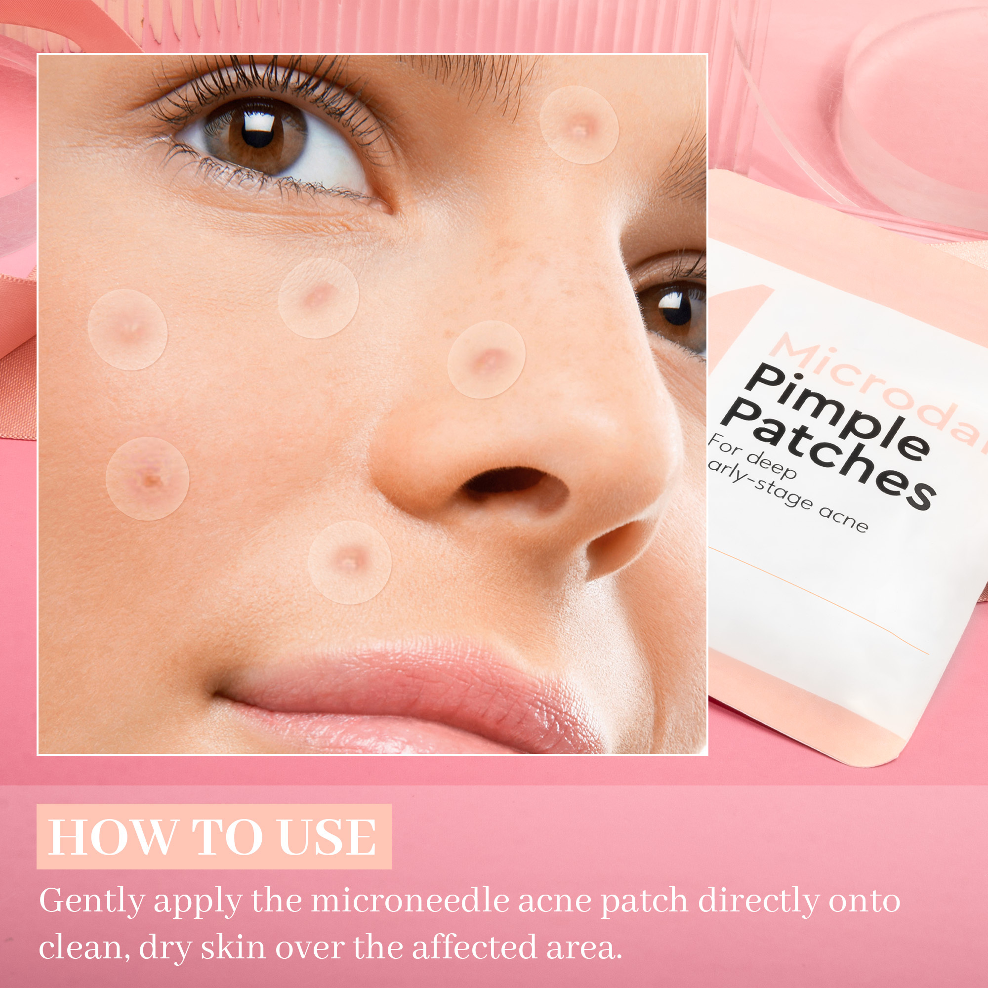Microneedle Acne Patch – Scar & Pimple Care