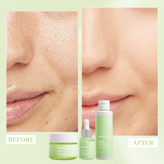 Exosome Centella Asiatica Cica Skin Care Set