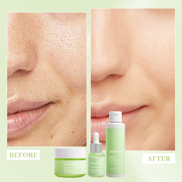 Exosome Centella Asiatica Cica Skin Care Set