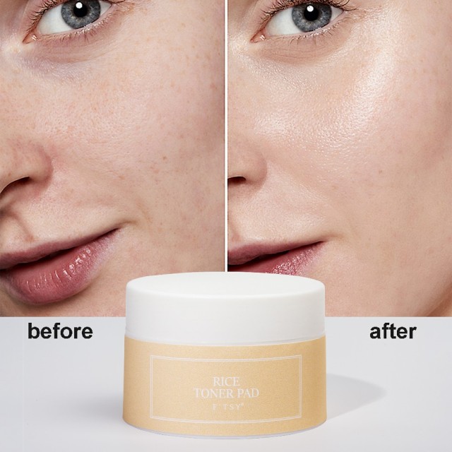 Rice Toner Pads, Hydration & Radiant