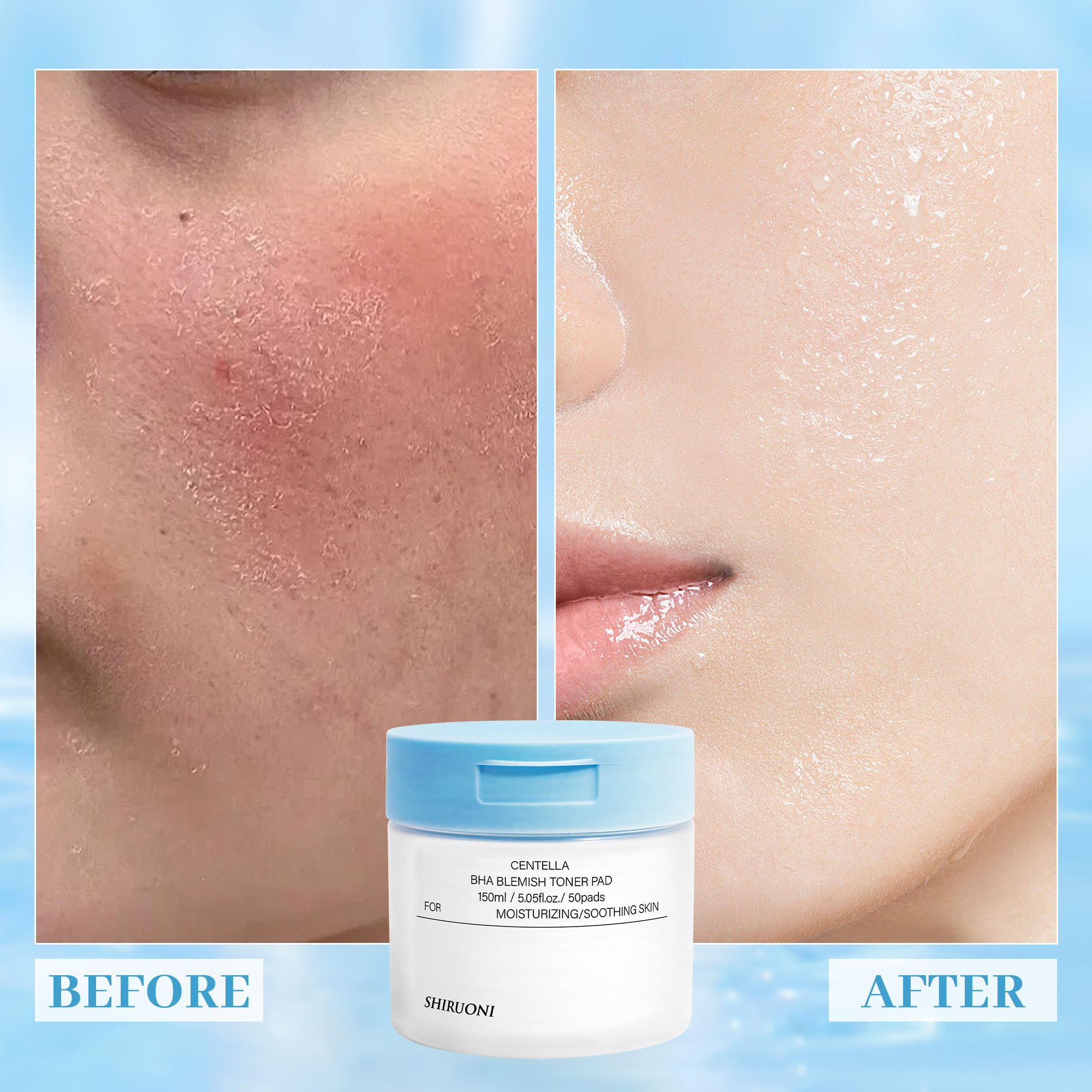 Centella BHA Blemish Toner Pads, Soothing & Exfoliating