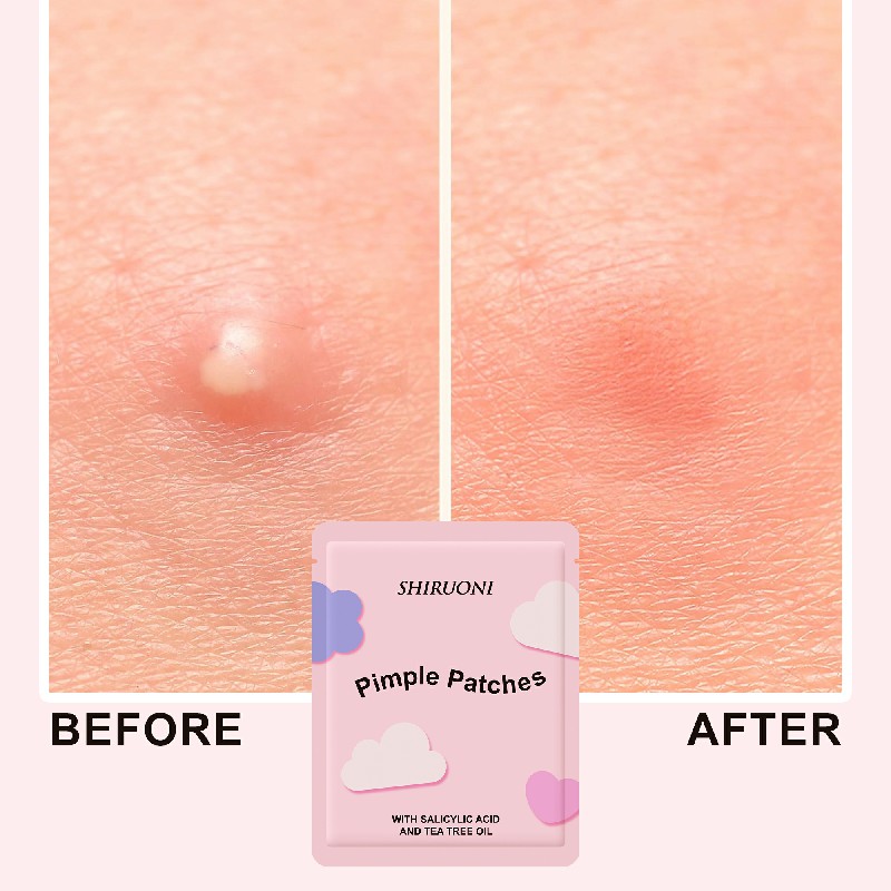 Fun-shaped, multi-colored acne patches that deliver targeted treatment with natural actives for fast, effective healing.