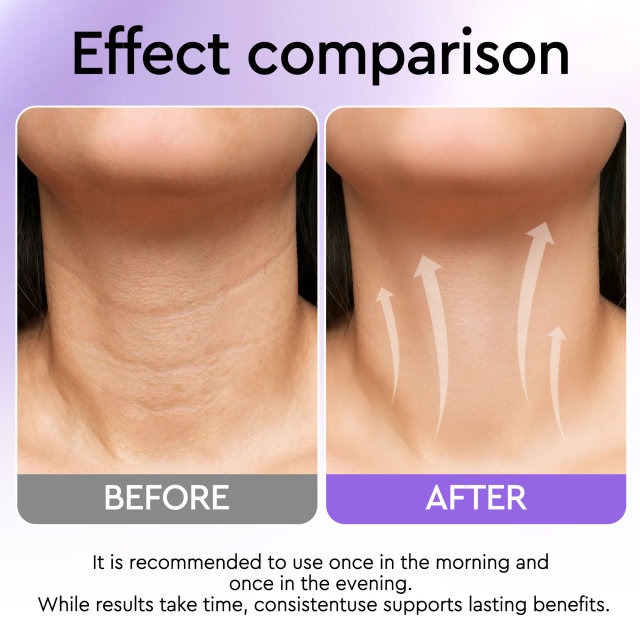 Neck Firming Cream [ In-stock ]