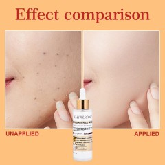 Exfoliant Rice Serum, Niacinamide & AHA BHA