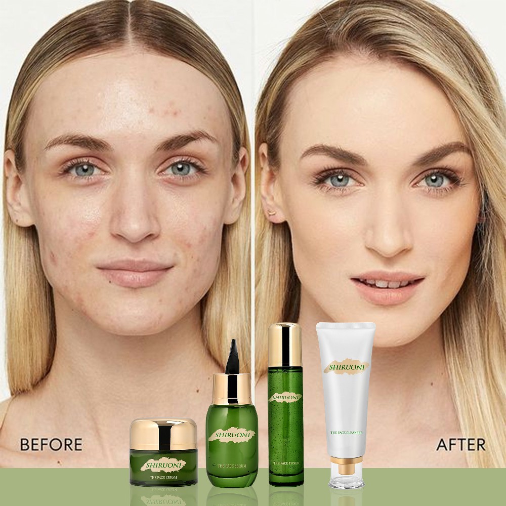 Centella Emerald Skincare Set