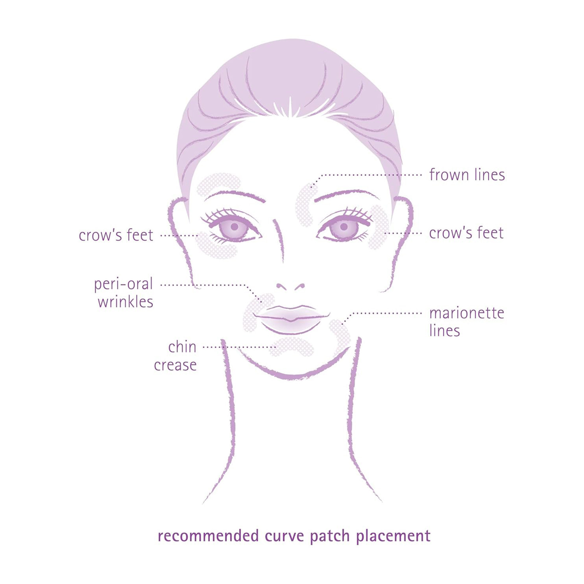 Facial Wrinkle Flattening Microneedle Patches