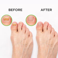 Tea Tree Oil Foot Soak with Dead Sea Salt