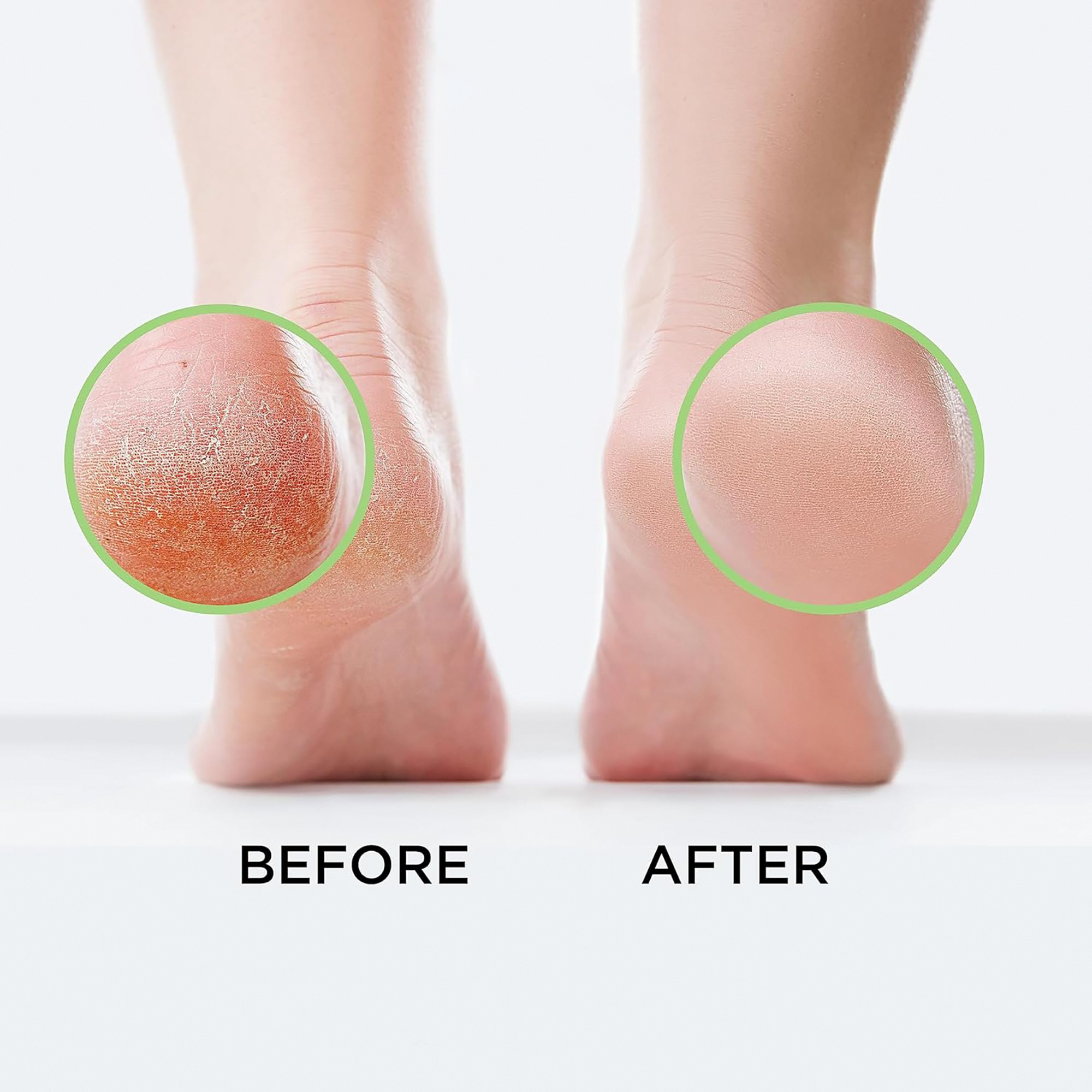 Tea Tree Oil Foot Soak with Dead Sea Salt