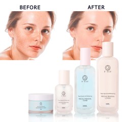 Freckle Removal Brightening Set